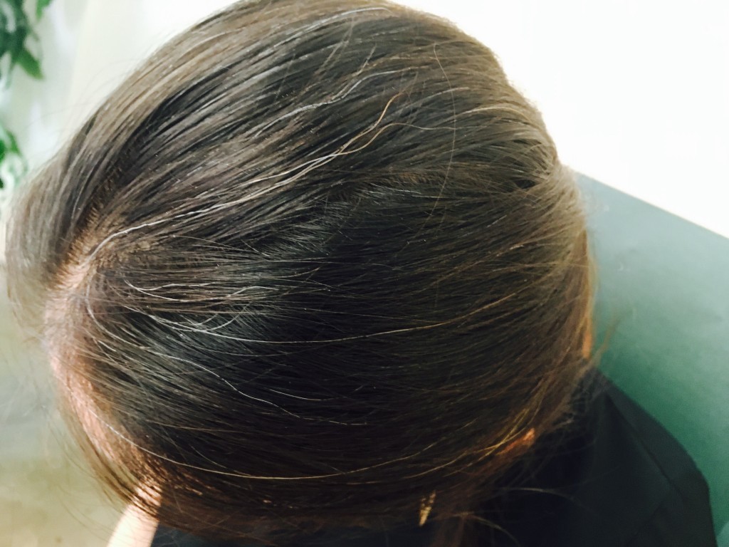 canas