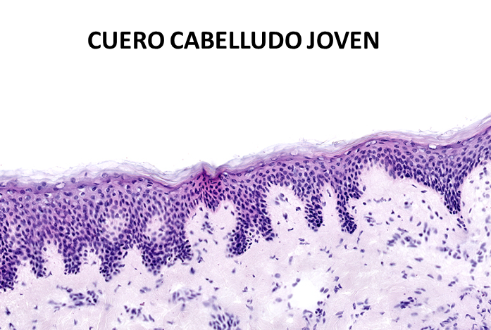 cuero cabelludo joven